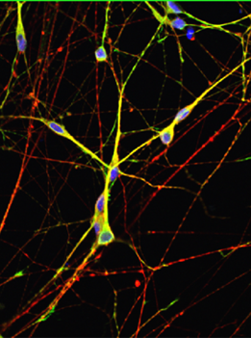 Retinal ganglion cells